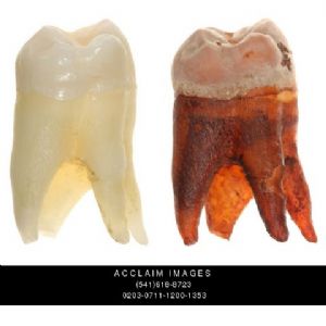 Saf Dental