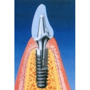 Dentarose Ağız ve Diş Sağlığı 